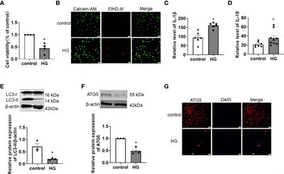 Differentially expressed tRNA-derived fragments and their roles in primary cardiomyocytes stimulated by high glucose